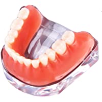 Modelo de Dientes de Sobreentadura Dental Implantes de Precisión Inferior Demo Modelo de Dientes de Enseñanza